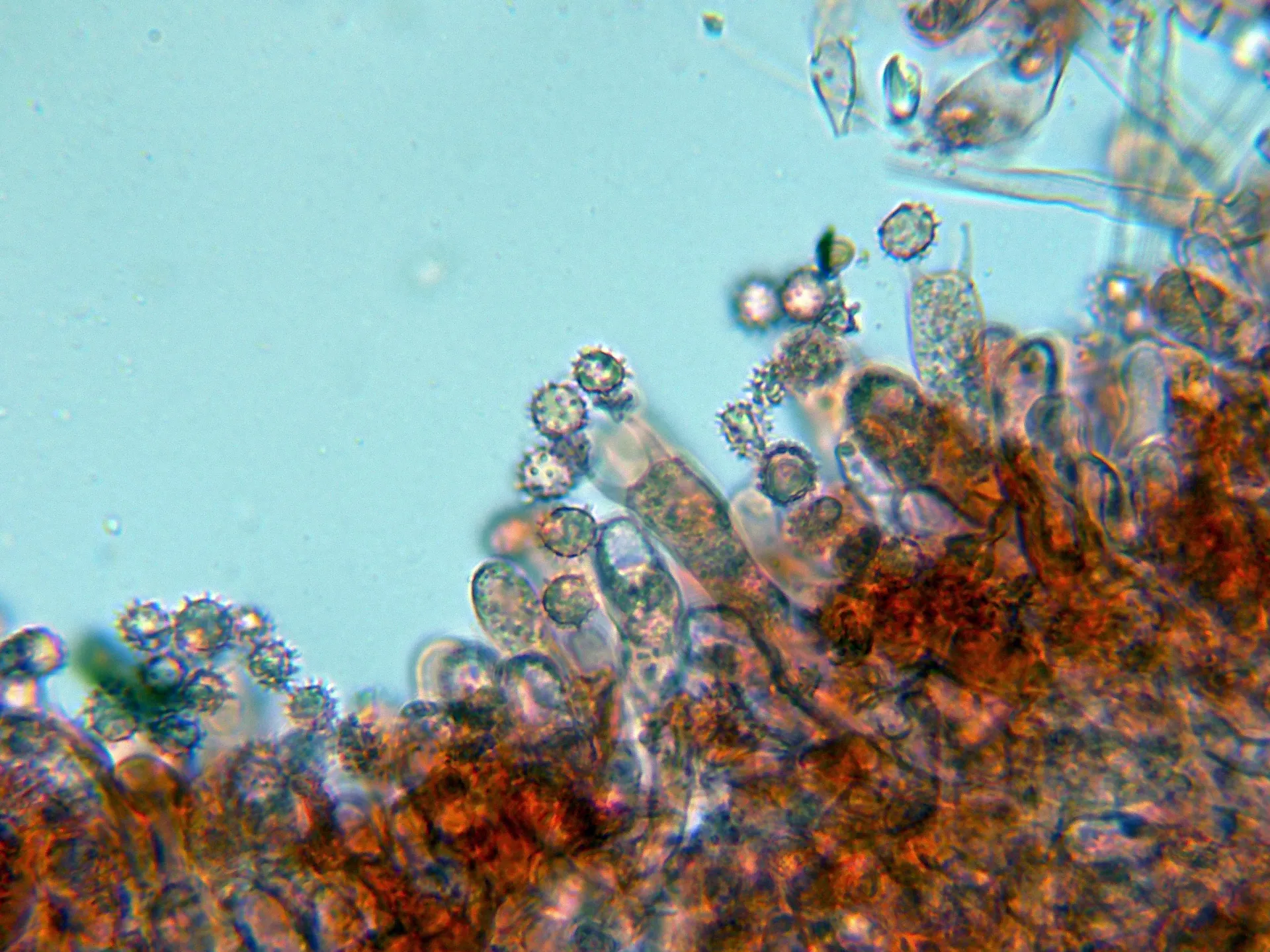 Microscopía de Tomentellopsis echinospora - 10 - Himenio-001